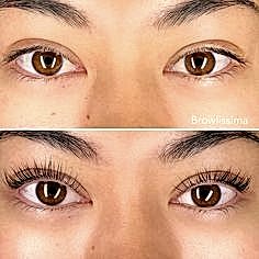 Kirpik Lifting - Görsel 2