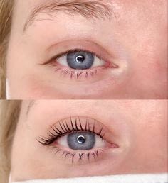 Kirpik Lifting - Görsel 3